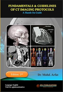 Fundamentals and Guidelines of CT Imaging Protocols